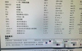 青少年胆红素偏高 胆红素偏高的原因及危害性