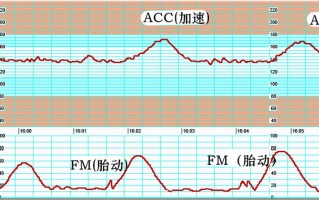 胎心率看男宝女宝 胎心率165生什么几率大