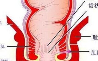 肛门坠胀的症状及可能原因解析