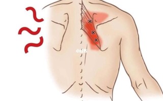 肩胛骨痛：成因、诊断与治疗方法