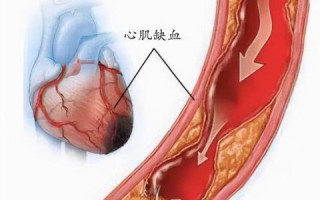 《深入了解：24小时动态心电图的工作原理与重要性》