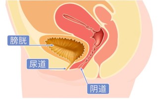 《女性尿道感染的症状解析及防治建议》