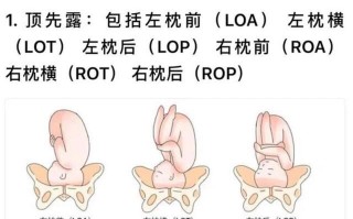 胎儿胎位 胎位的表示LOA,ROA...