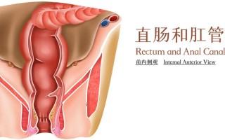 脱肛是什么样子 脱肛怎么治疗女性