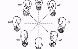 揭秘ROA的意思：从概念到应用全面解析