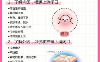 脸上的闭口粉刺怎么彻底根除 粉刺该怎么去除