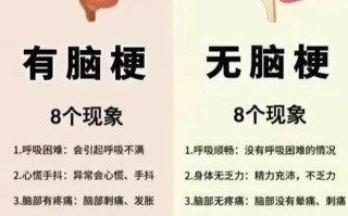 轻微脑梗塞：认识、预防与治疗