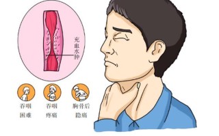 食道癌的症状及表现