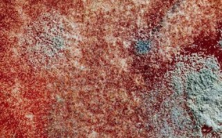 揭秘肝囊肿的形成过程：成因、发展与预防策略