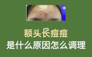 《头上长痘痘的原因解析与应对策略》