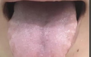 脾气虚的症状及其影响：深入了解与应对