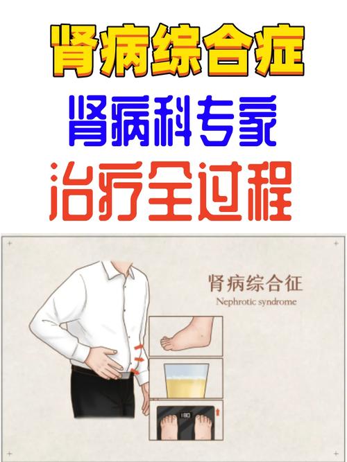 肾病综合症能治好吗大概需要多久 小孩肾病综合症能治好吗-第1张图片-其人生活百科