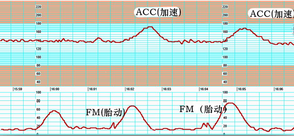 胎心率看男宝女宝 胎心率165生什么几率大-第1张图片-其人生活百科