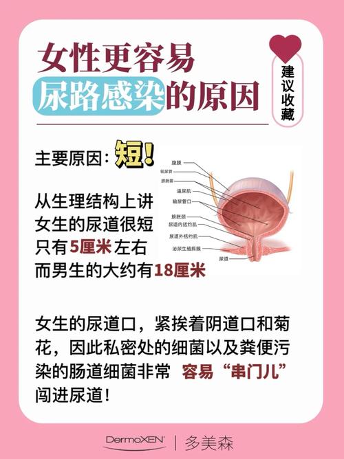 女性尿路感染的识别与应对——了解、预防和治疗的重要性-第1张图片-其人生活百科