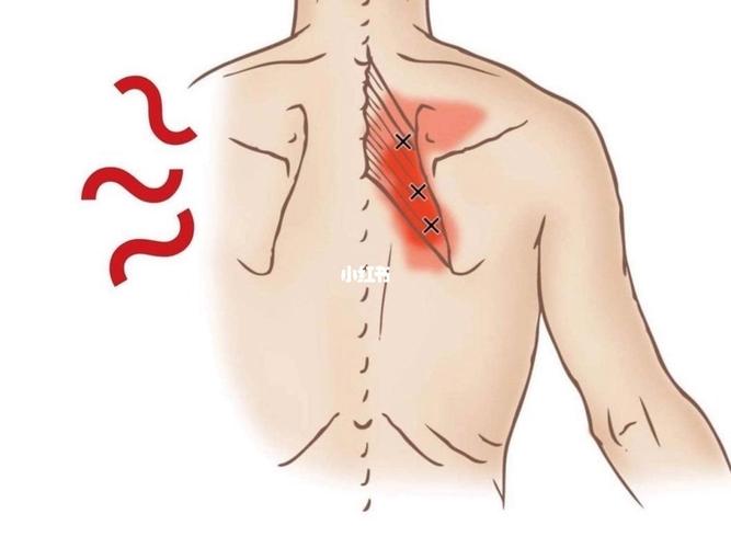 肩胛骨痛：成因、诊断与治疗方法-第1张图片-其人生活百科