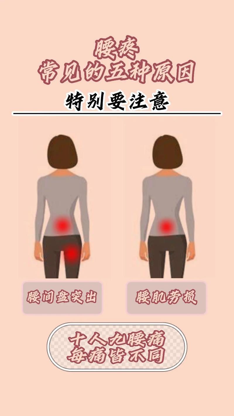 女性腰疼背后的真相：那些潜在的原因-第2张图片-其人生活百科