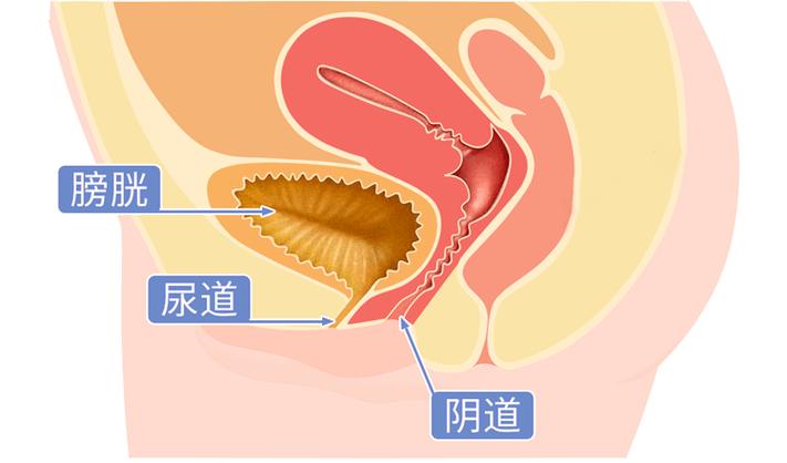 《女性尿道感染的症状解析及防治建议》-第1张图片-其人生活百科