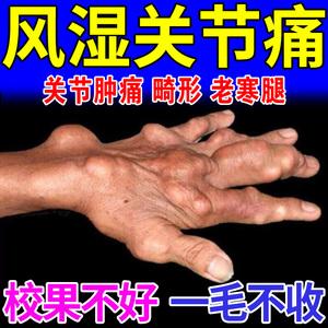 全面解析治疗风湿性关节炎的有效方法与策略-第1张图片-其人生活百科