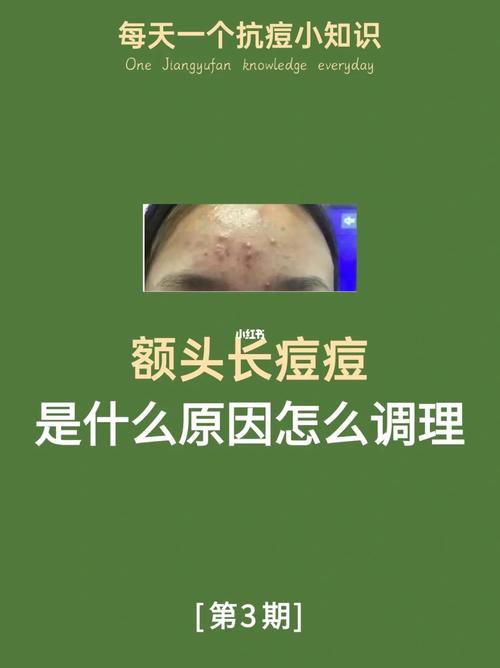 《头上长痘痘的原因解析与应对策略》-第1张图片-其人生活百科