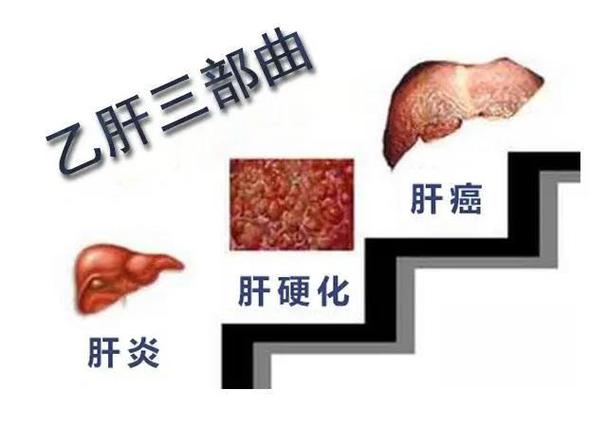 肝炎双重感染：深入了解与治疗策略-第1张图片-其人生活百科