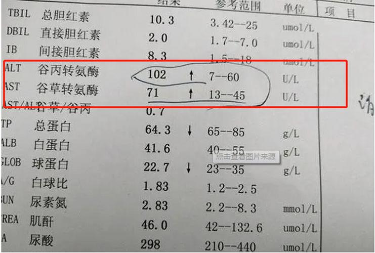 谷丙转氨酶过高是什么原因 谷丙转氨酶200多意味着什么-第2张图片-其人生活百科