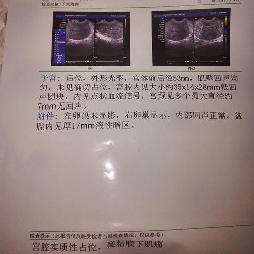 一个月来两次月经是怎么回事 月经量少颜色黑褐色是什么原因-第2张图片-其人生活百科