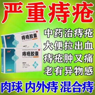 痔疮用什么药效果比较好 治疗痔疮的常用药物-第1张图片-其人生活百科