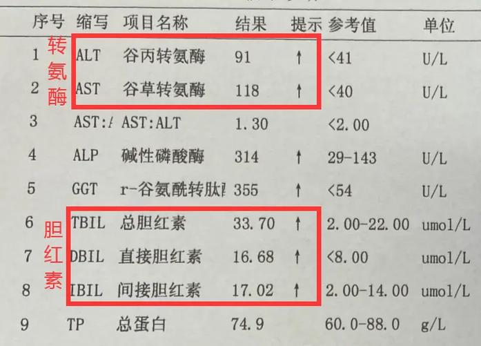 肝功十项检查结果怎么看 肝功能检查解读-第1张图片-其人生活百科