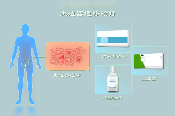 生殖性疱疹吃什么药最好用 生殖疱疹什么药才能彻底好-第1张图片-其人生活百科