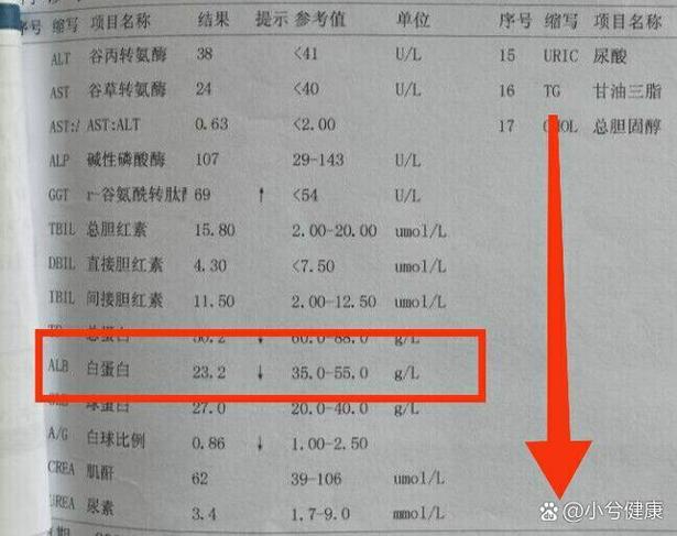 白蛋白偏低说明什么 白蛋白低于40意味着什么-第1张图片-其人生活百科