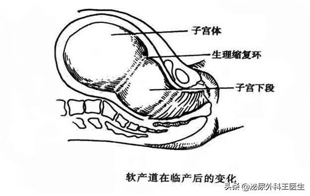 子宫切除有什么影响和后遗症 子宫切除对身体有多大的危害-第2张图片-其人生活百科