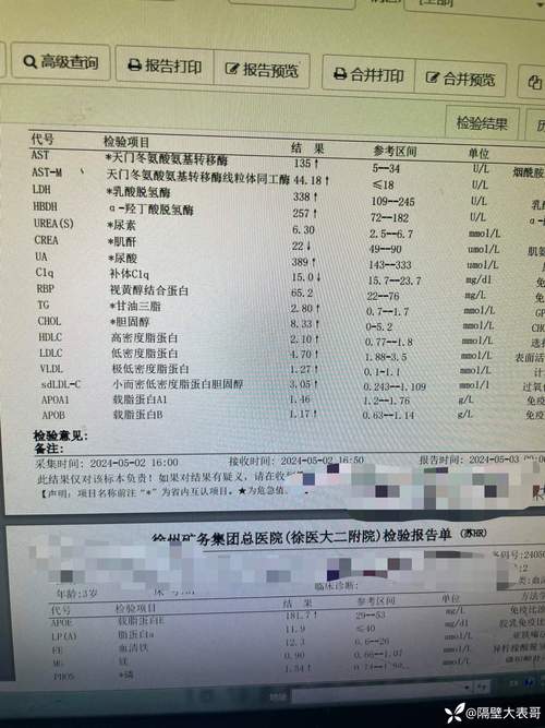 青少年胆红素偏高 胆红素偏高的原因及危害性-第1张图片-其人生活百科